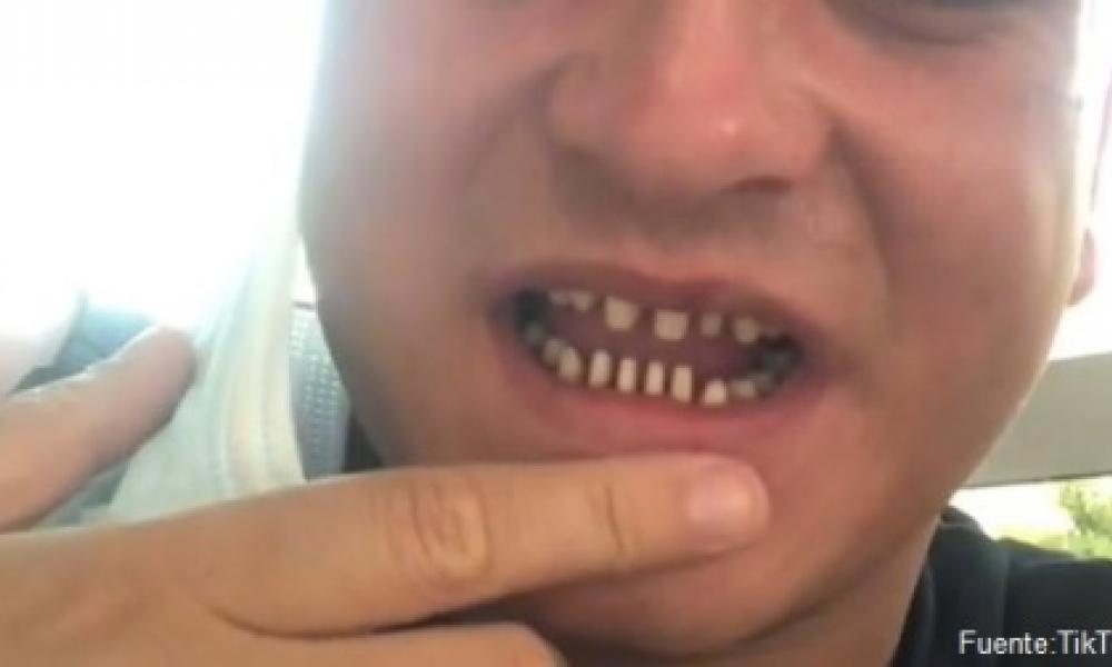 El Consejo General de Dentistas alerta sobre la nueva tendencia que afecta a los ciudadanos de Reino Unido: el TurkeyTeeth